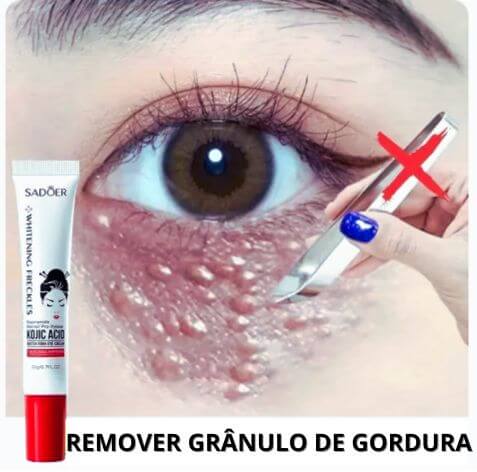 Creme removedor de grânulos de gordura, que combate o inchaço e a inflamação, firma a pele, reduz olheiras, elimina linhas finas e repara a barreira da pele