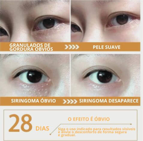 Creme removedor de grânulos de gordura, que combate o inchaço e a inflamação, firma a pele, reduz olheiras, elimina linhas finas e repara a barreira da pele